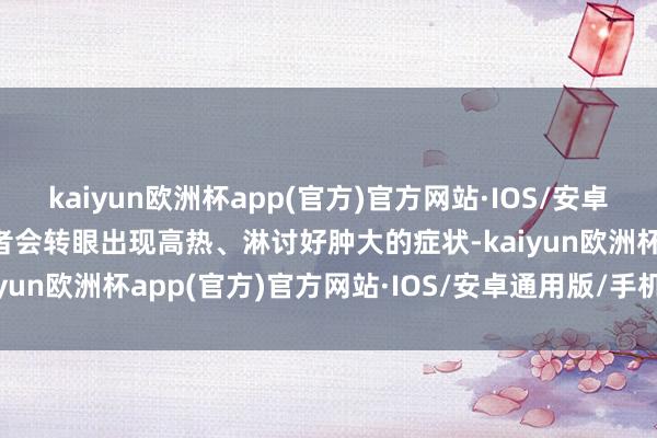 kaiyun欧洲杯app(官方)官方网站·IOS/安卓通用版/手机APP下载患者会转眼出现高热、淋讨好肿大的症状-kaiyun欧洲杯app(官方)官方网站·IOS/安卓通用版/手机APP下载